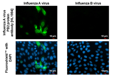 Anti-Influenza A virus PB2 protein antibody [HL1994] used in Immunocytochemistry/ Immunofluorescence (ICC/IF). GTX637895
